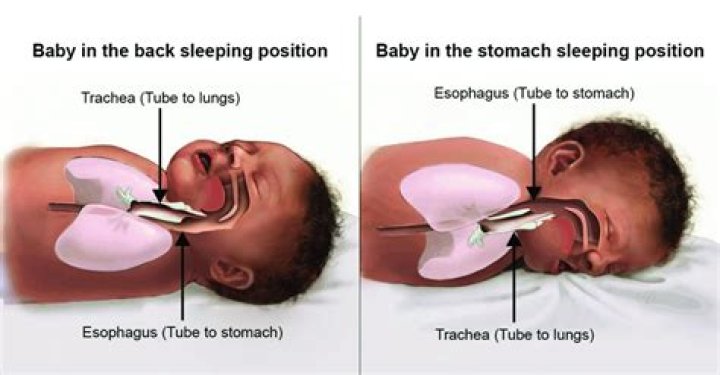 Can a baby choke if he spits up in his sleep?