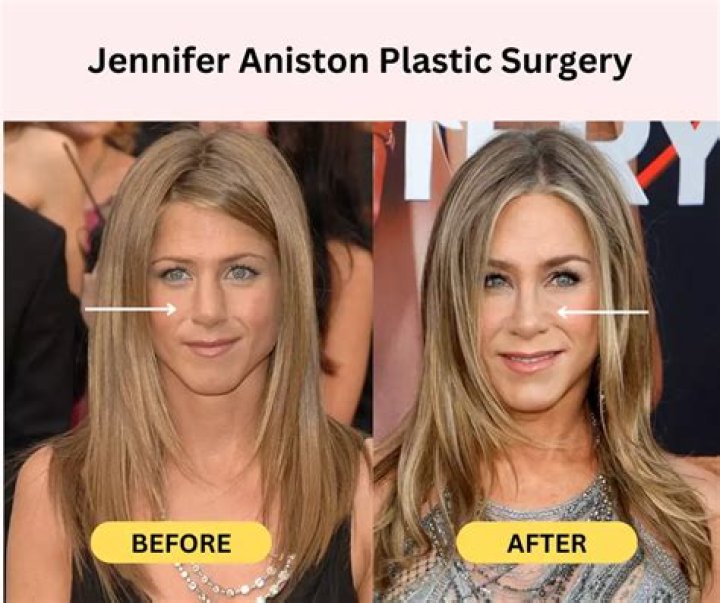 Get Insites To Her Plastic Sugery Situation.