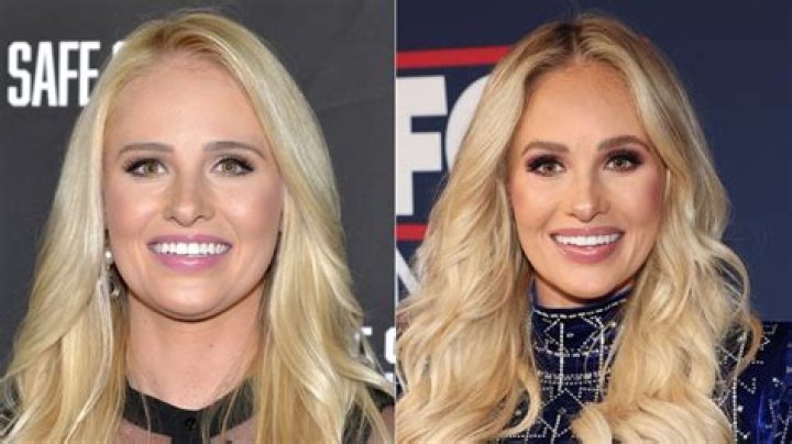 Unveiling Tomi Lahren's Transformation: A Journey Before Surgery