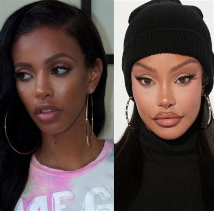 Yodit Yemane Before Plastic Surgery